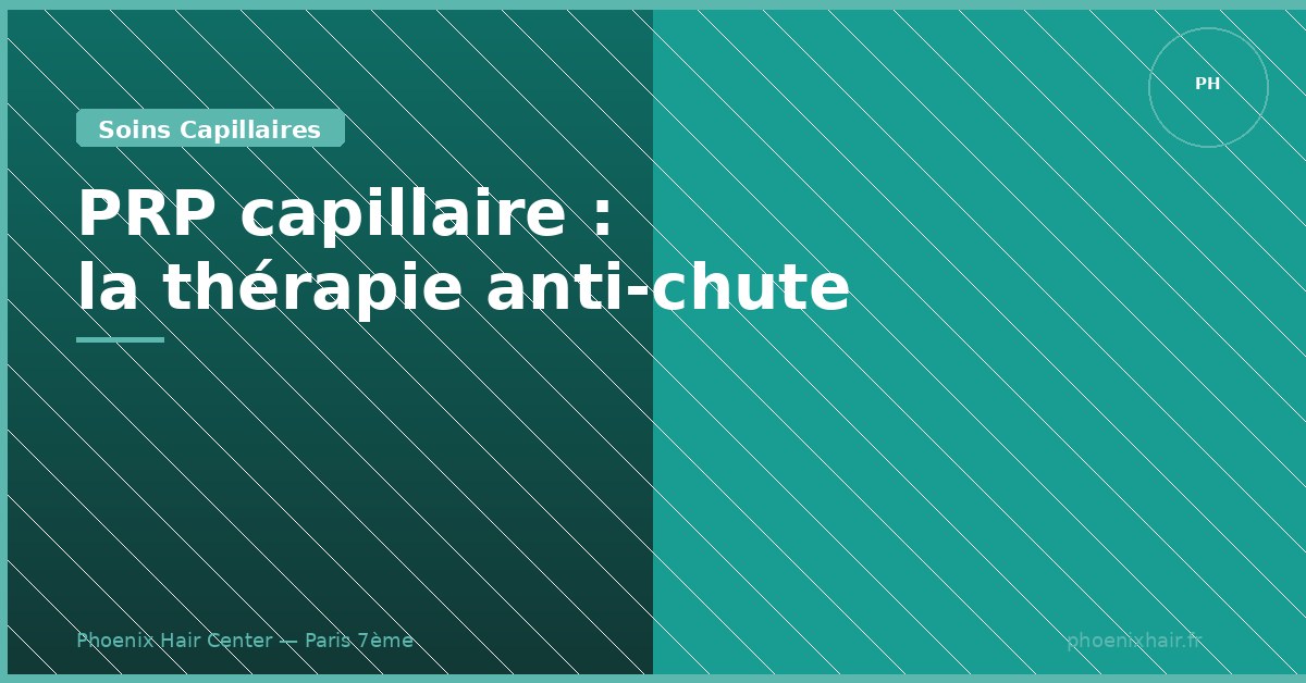 PRP capillaire traitement anti-chute de cheveux naturel Paris