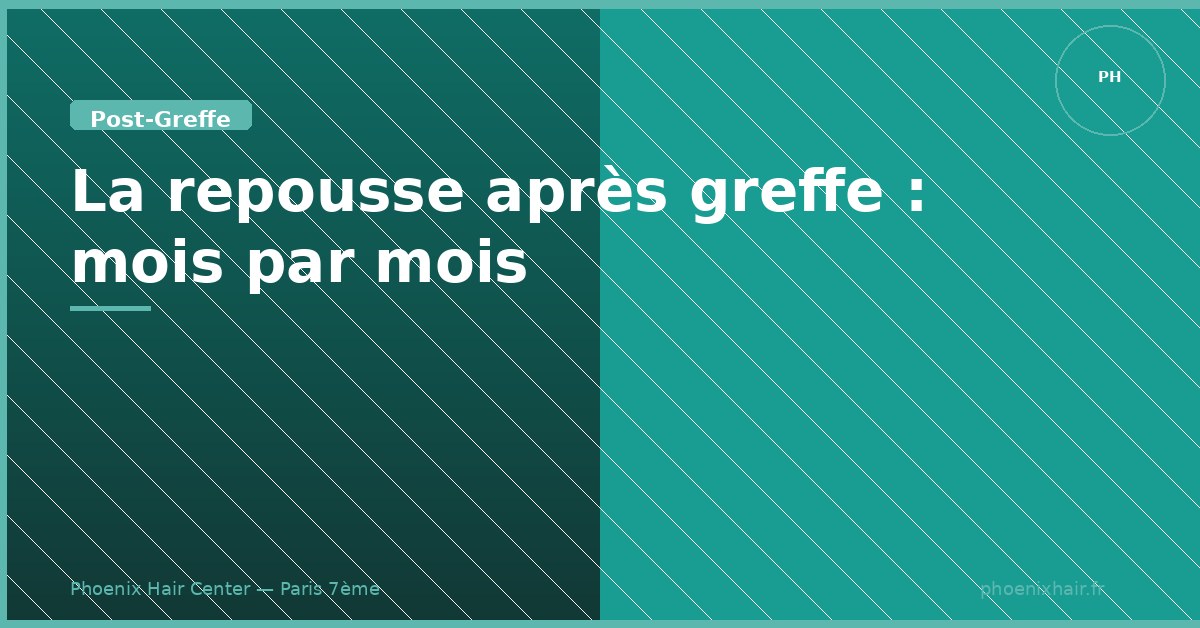 Repousse des cheveux après une greffe FUE — calendrier mois par mois